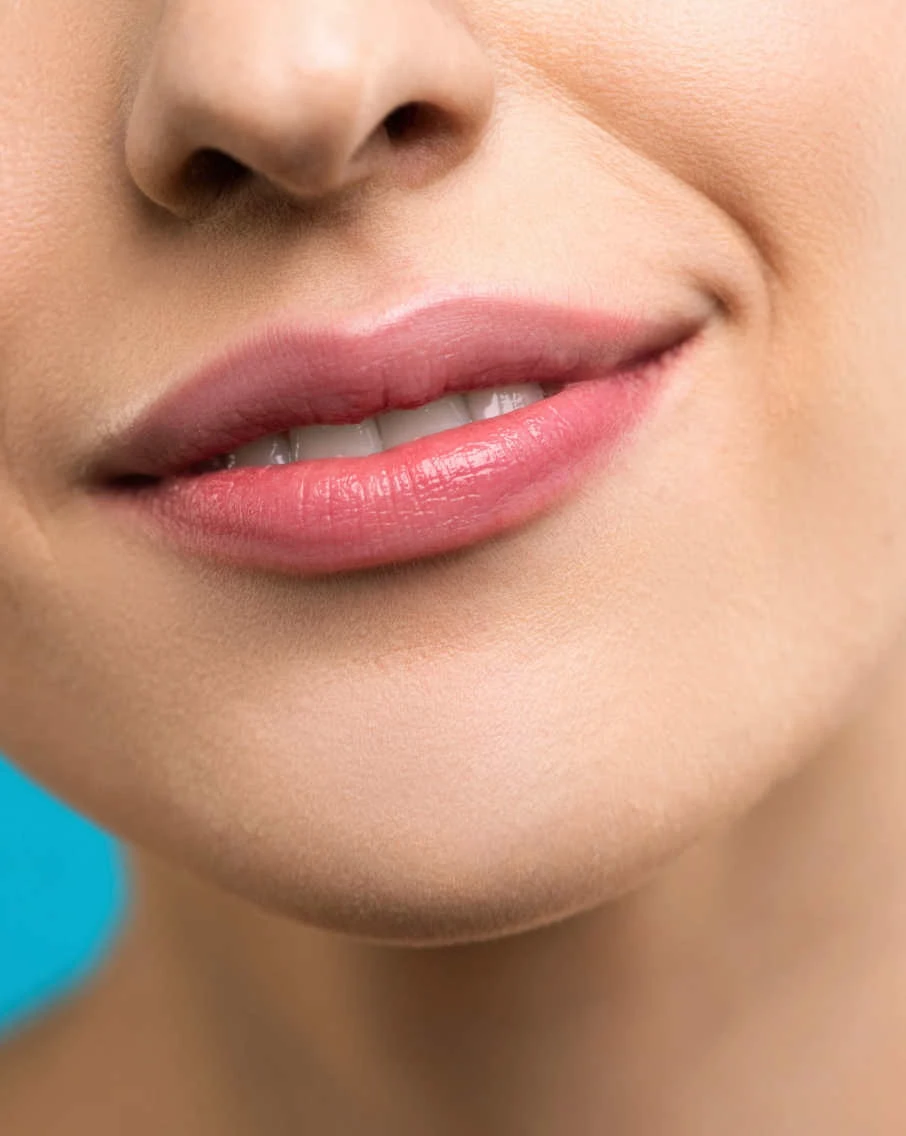 Different Types of Lip Augmentation Procedures in Islamabad