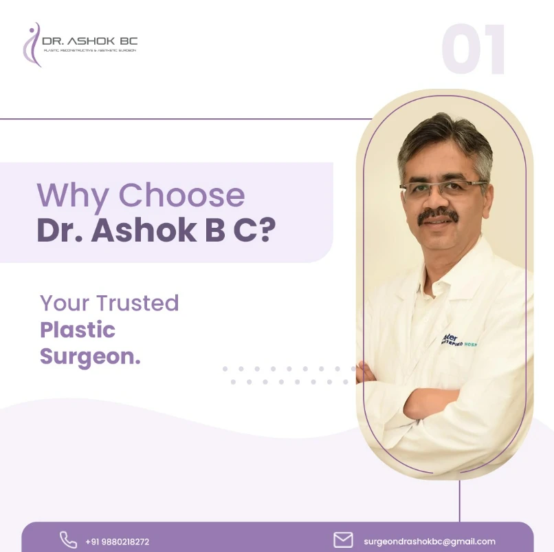 The Complete Guide to Aesthetic Surgery: Change Your Looks with Rhinoplasty Surgery