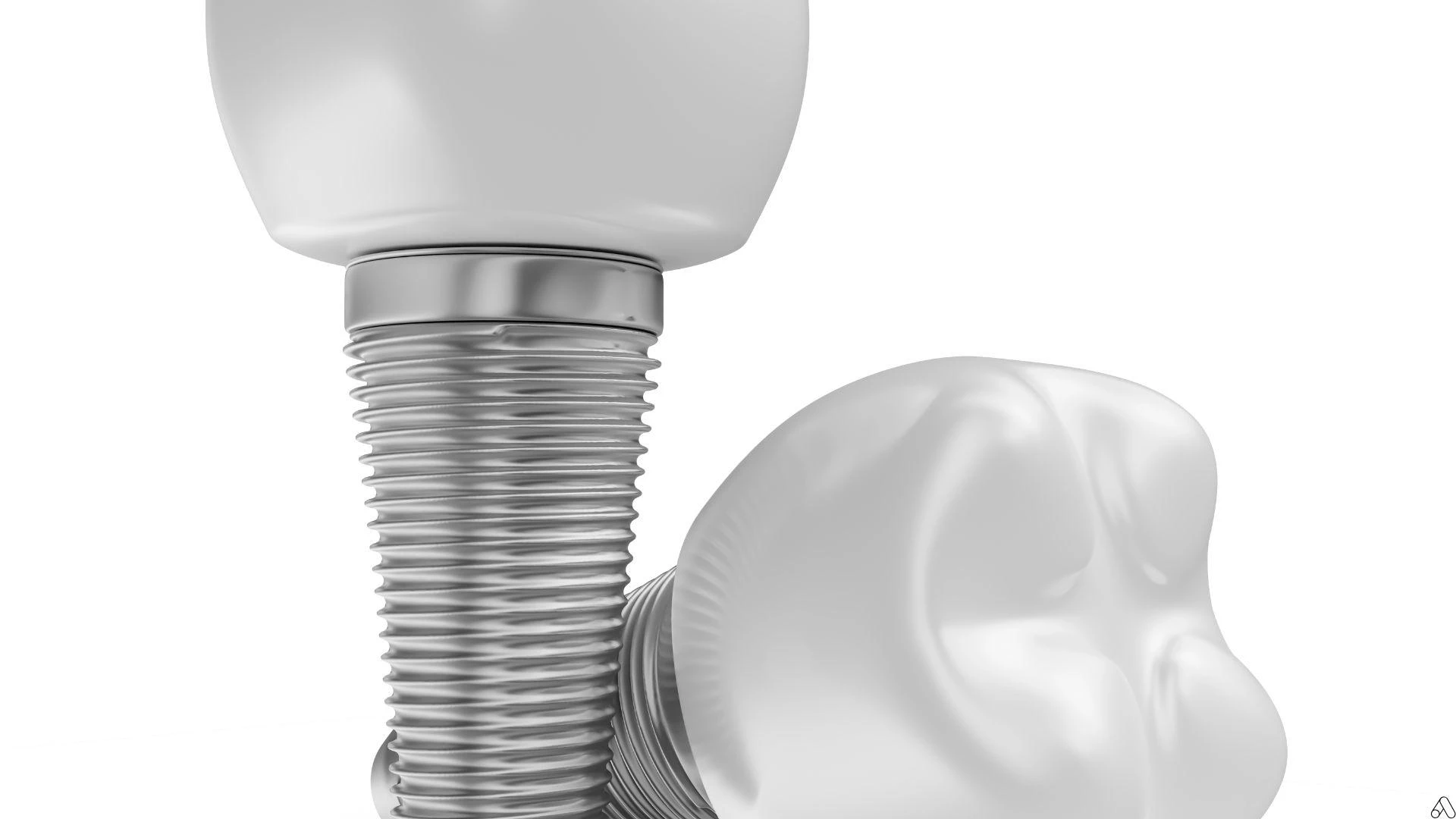 Are Dental Implants Painful? A Guide to What Happens During the Process