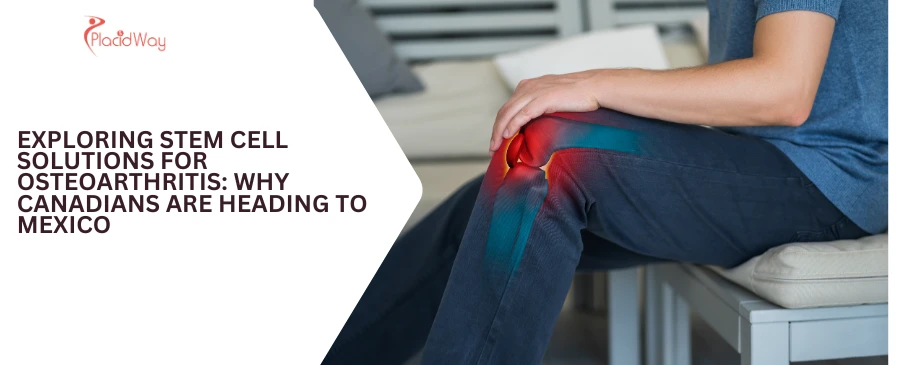 Draft: My Post TitleExploring Stem Cell Solutions for Osteoarthritis: Why Canadians Are Heading to Mexico
