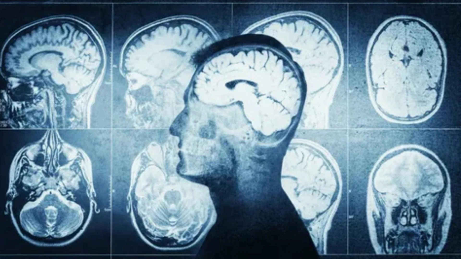 What Are the Three Types of Brain Scans?