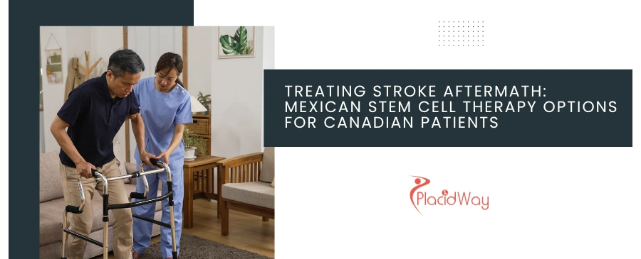 Stem Cell Therapy for Stroke Recovery: Affordable Options in Mexico for Canadian Patients
