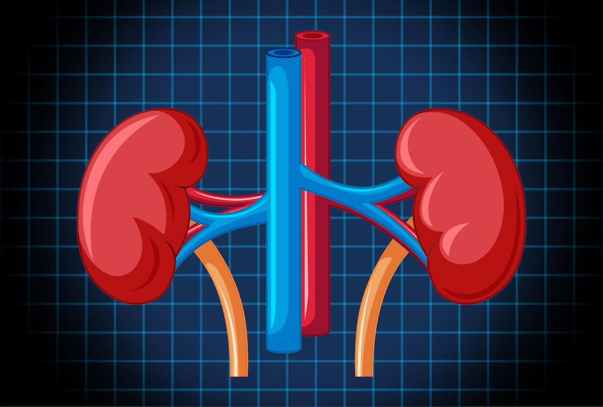 History of Kidney Transplant