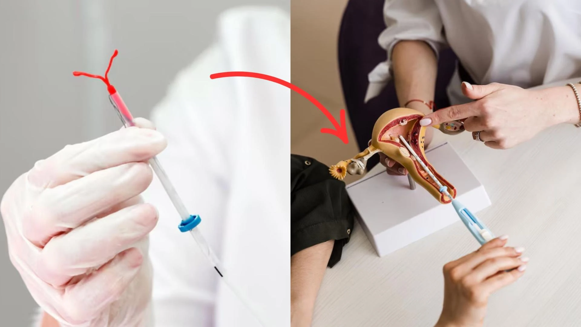 The Complete Guide to Contraceptive Implant Removal in London