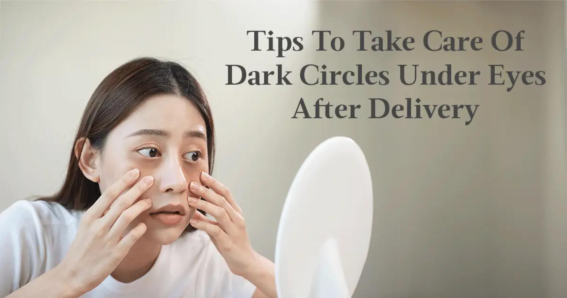 Post-Pregnancy Dark Circles Under Eyes — Causes & Tips To Overcome Them
