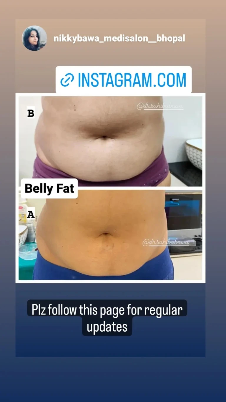 How to Get Firmer Skin: Best Belly Skin-Tightening Treatments in Bhopal