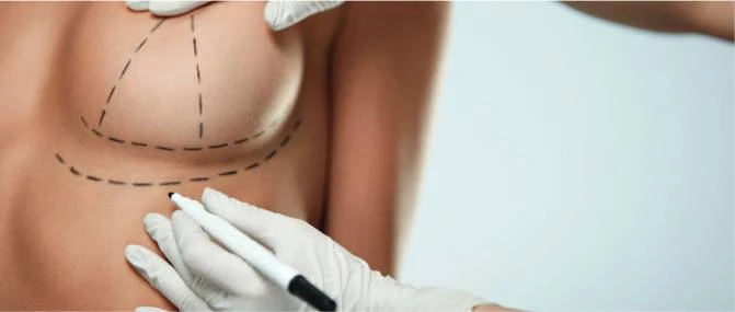Breast Lift in Dubai: Restore Youthful Contours with Expert Care
