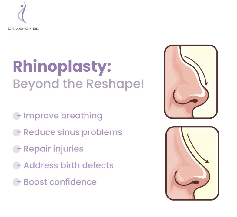 Enhance Your Facial Aesthetics with Nose Surgery in Bangalore