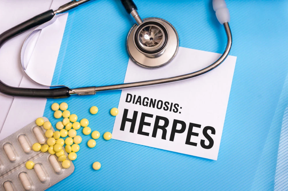 Why Herpes Testing in NYC Is Essential for Your Sexual Health
