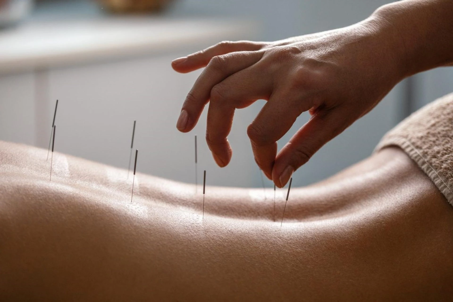 Exploring the Ancient Healing Art of Acupuncture in Edmonton