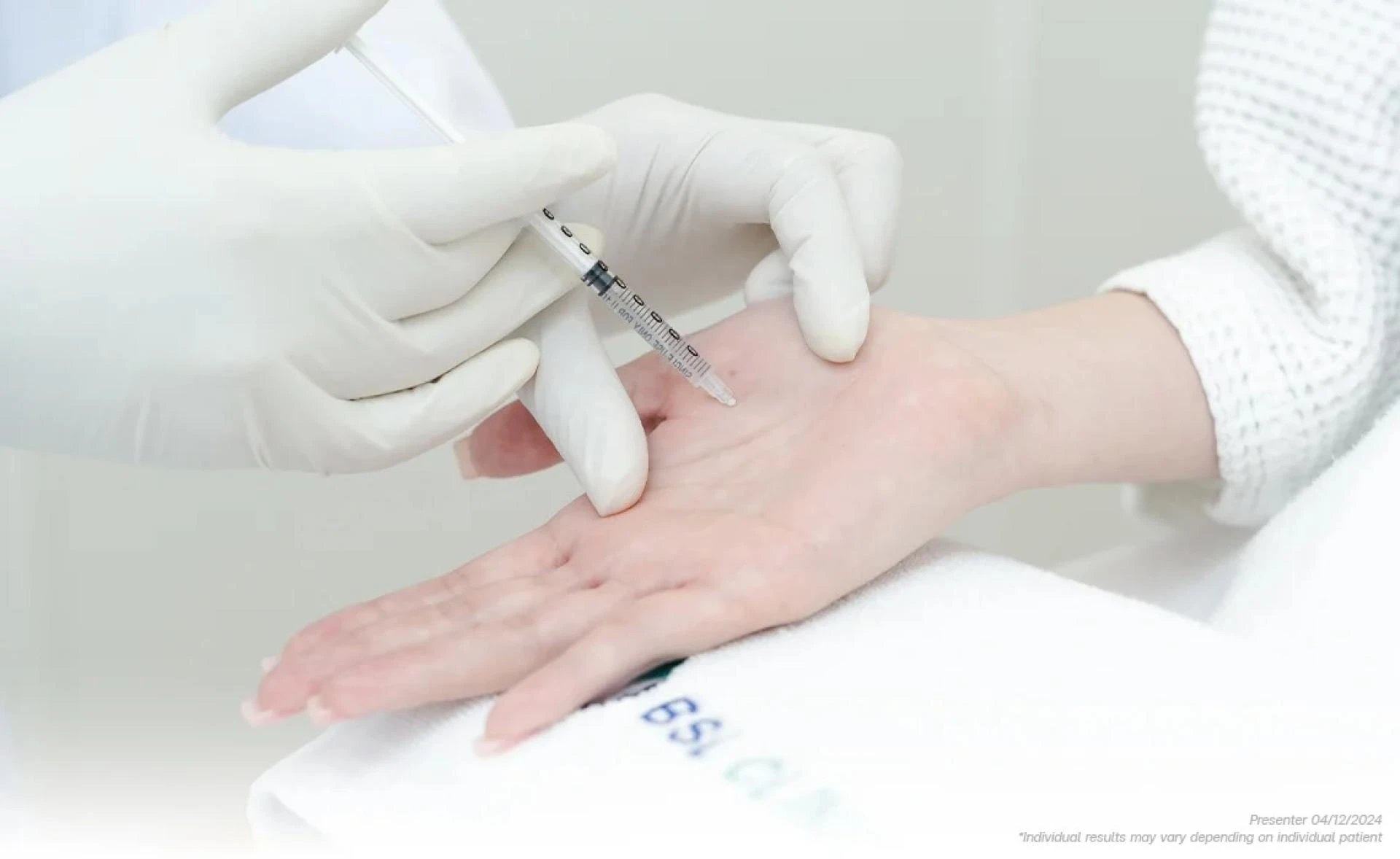 Knowing the Causes, Effects, and Treatment Options of Hyperhidrosis