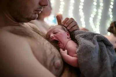 Adult Circumcision in Dallas: A Comprehensive Guide 