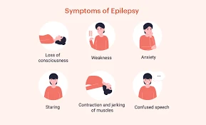 Emergency Seizure Care: What to Do During an Epileptic Episode