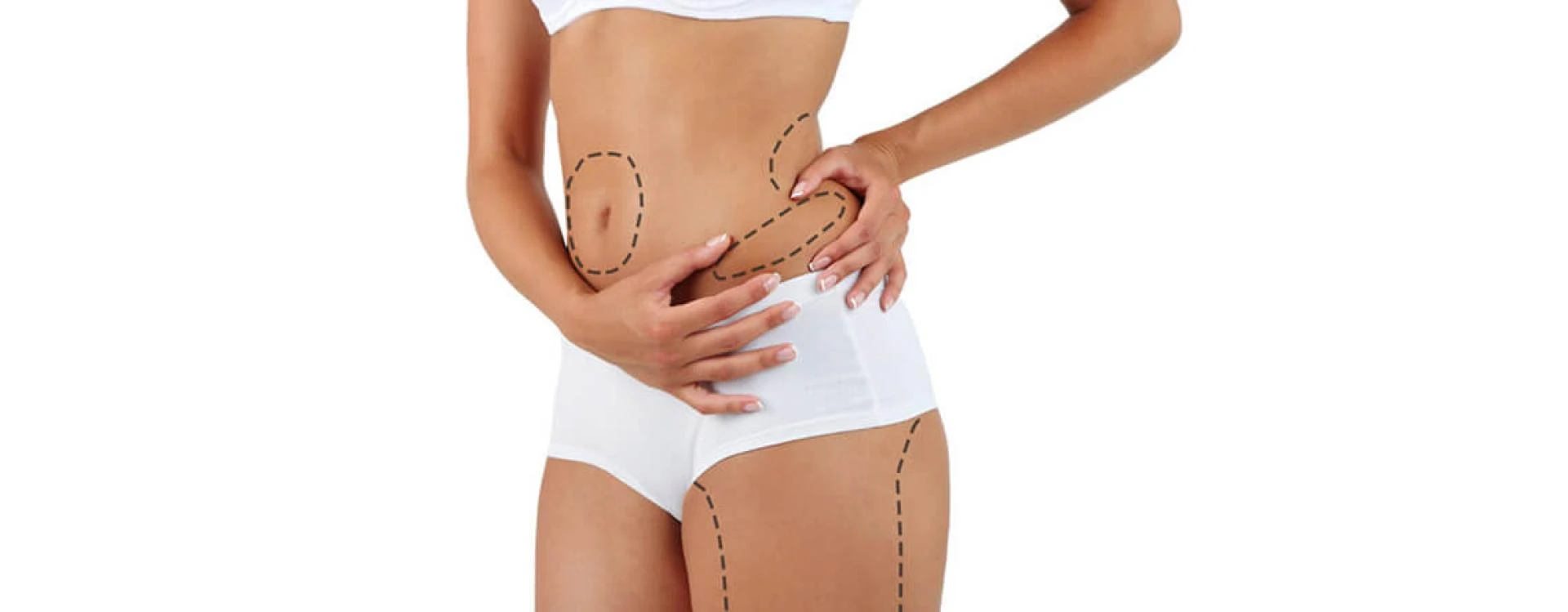 Tips for a Smooth Recovery After Liposuction in Islamabad