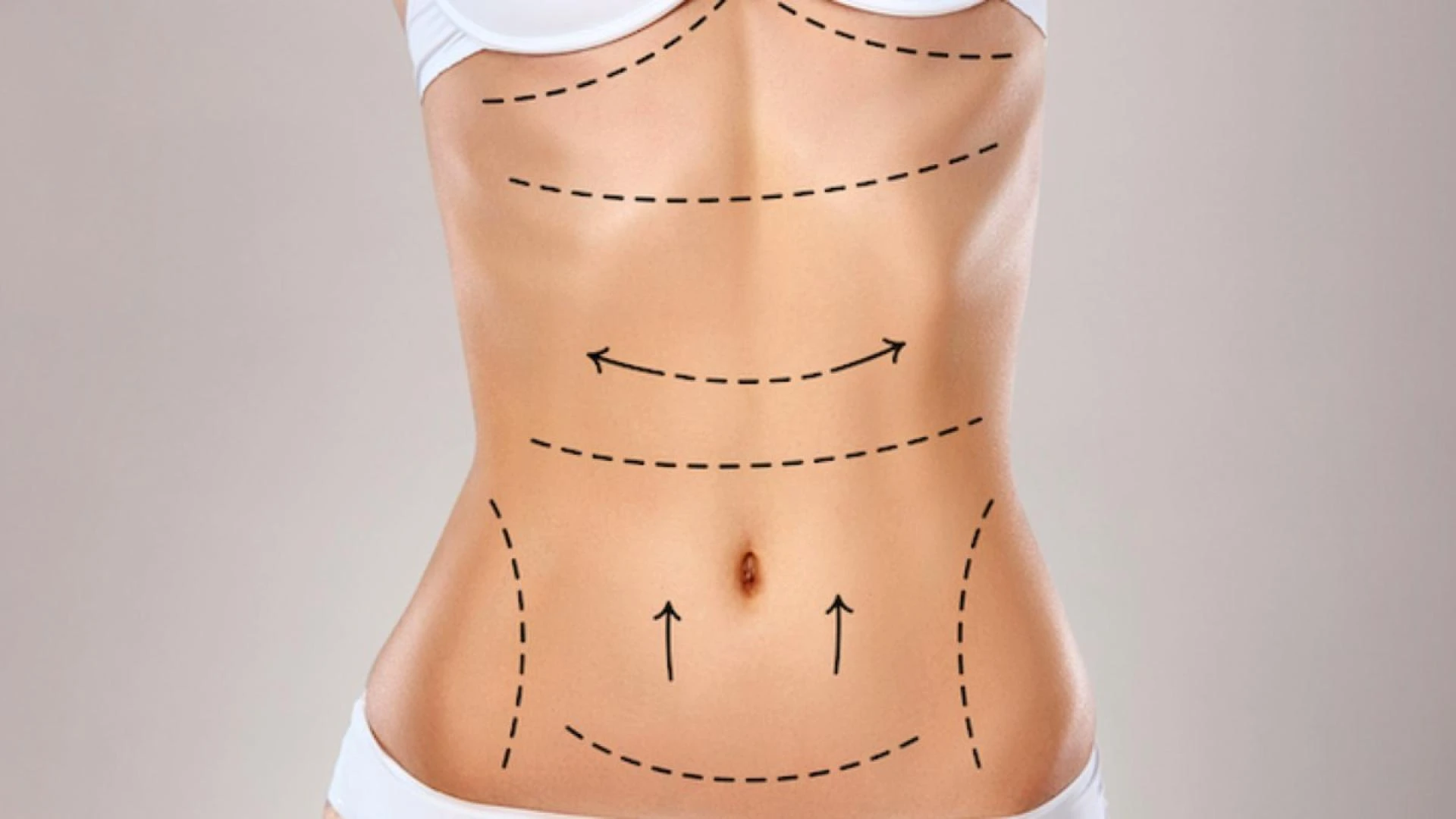 What to Expect in a Tummy Tuck Consultation in Islamabad