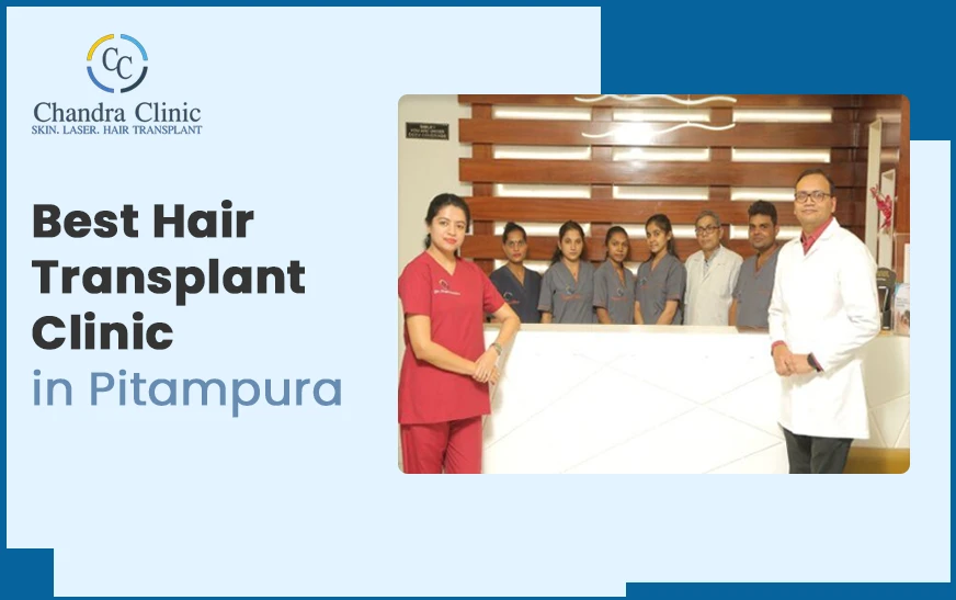 What to Expect 1 Month After a Hair Transplant