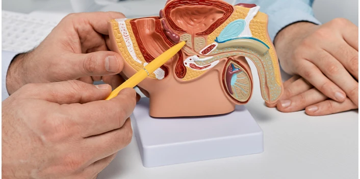 A Comprehensive Guide to Penile Implants Surgery in Delhi