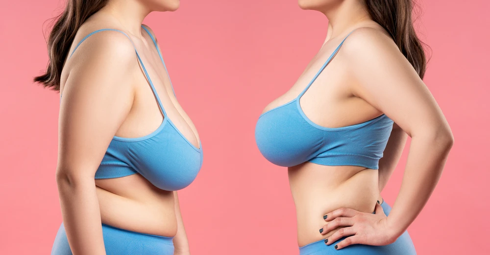 Breast Reduction and Augmentation Surgery in Ghana: A Growing Trend in Cosmetic Enhancement