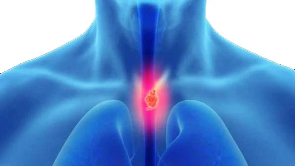 Laparoscopic Esophageal Surgery in Delhi: Precision Care for Complex Esophageal Disorders