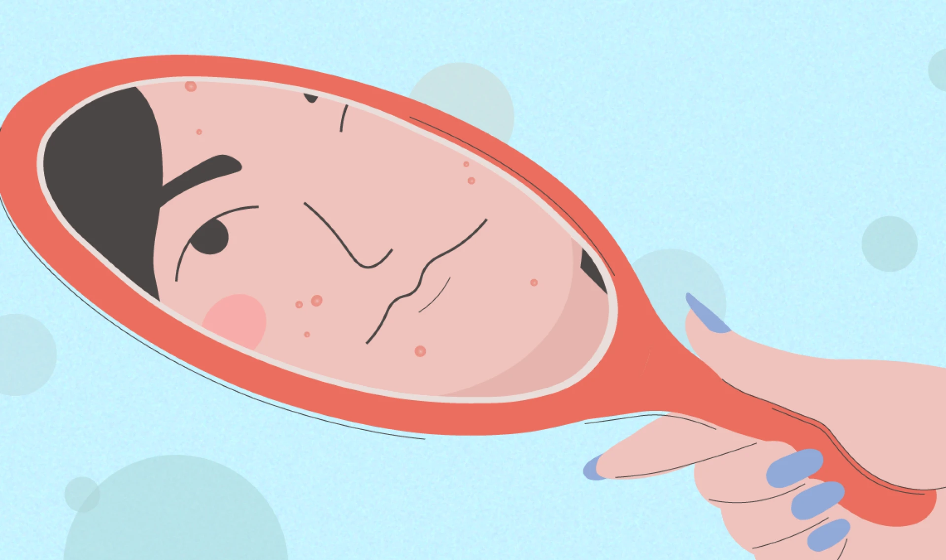 Period Acne: A Comprehensive Guide to Understanding and Managing Breakouts