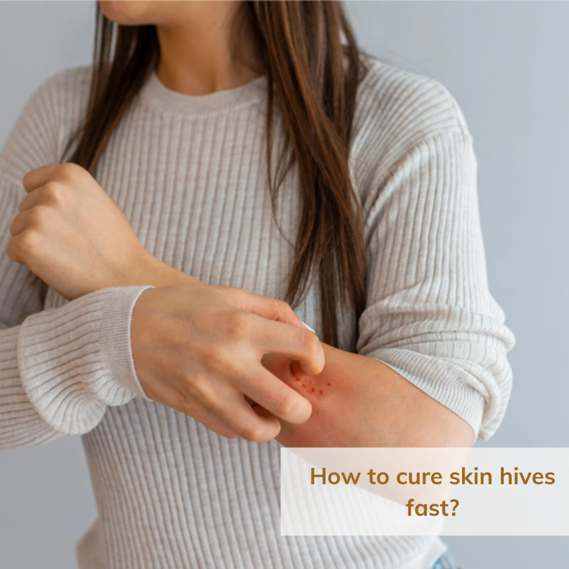 How to cure skin hives fast?