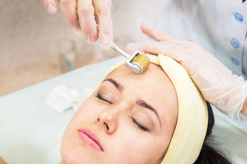 Microneedling Treatment in Delhi: Reverse Scars, Wrinkles, and Pigmentation