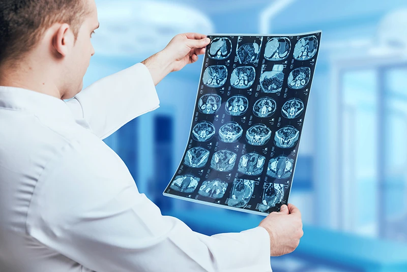 Top 6 Facts About Radiology Transcription That You Should Know