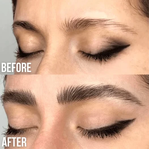 Bold Brows Are Back: The Ultimate Guide to Natural Eyebrow Thickening
