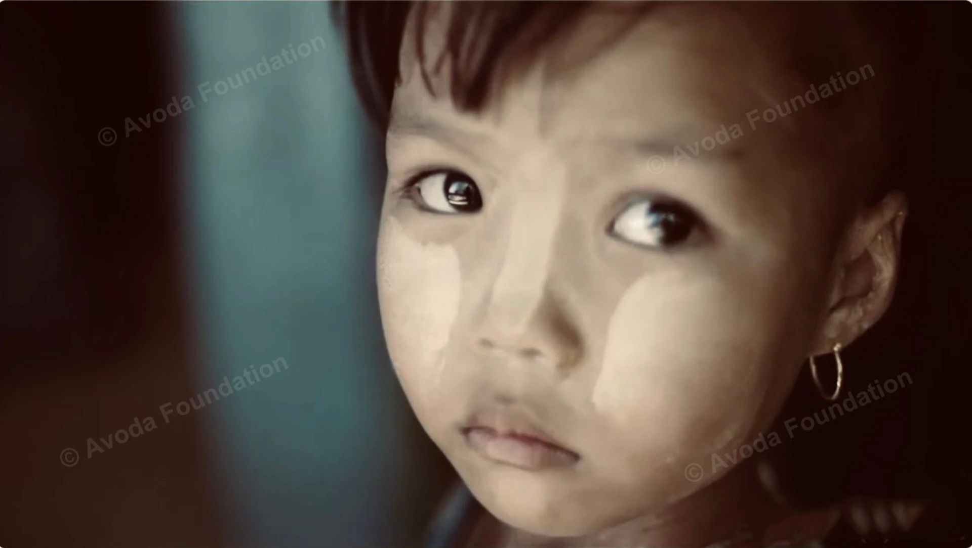 The War and Poverty Have Robbed the Lives of Displaced Children