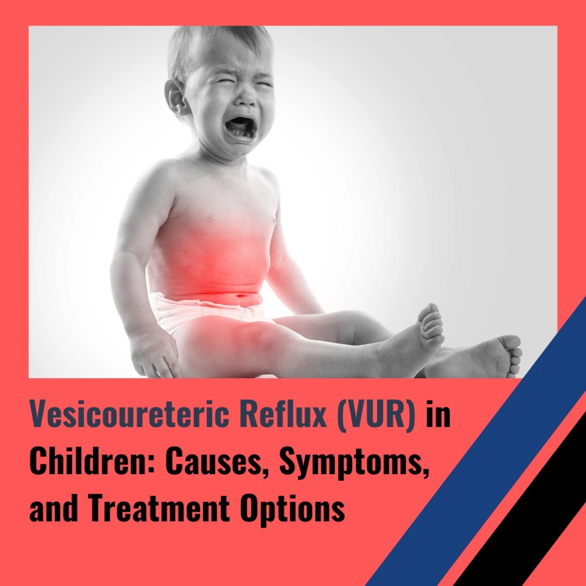 Vesicoureteral Reflux Surgery in Children: Expert Treatment in Delhi