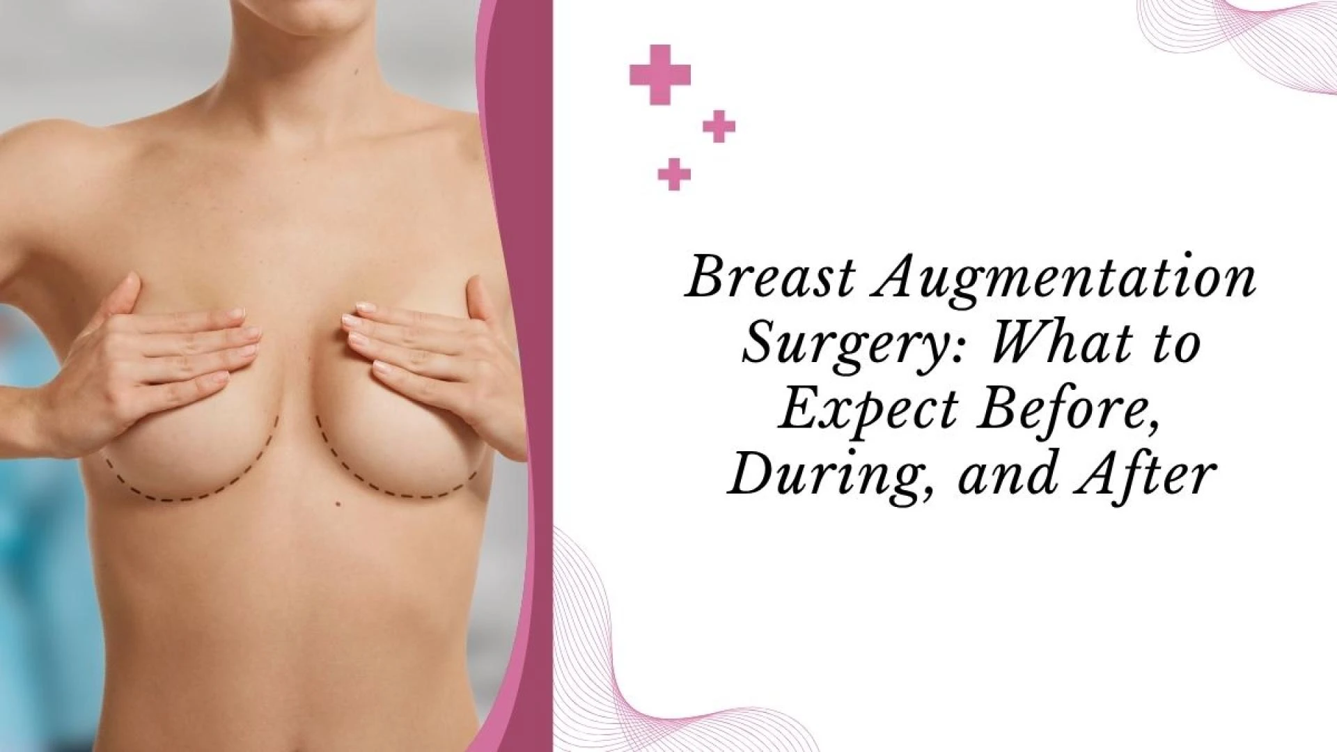 Breast Augmentation Surgery: What to Expect Before, During, and After