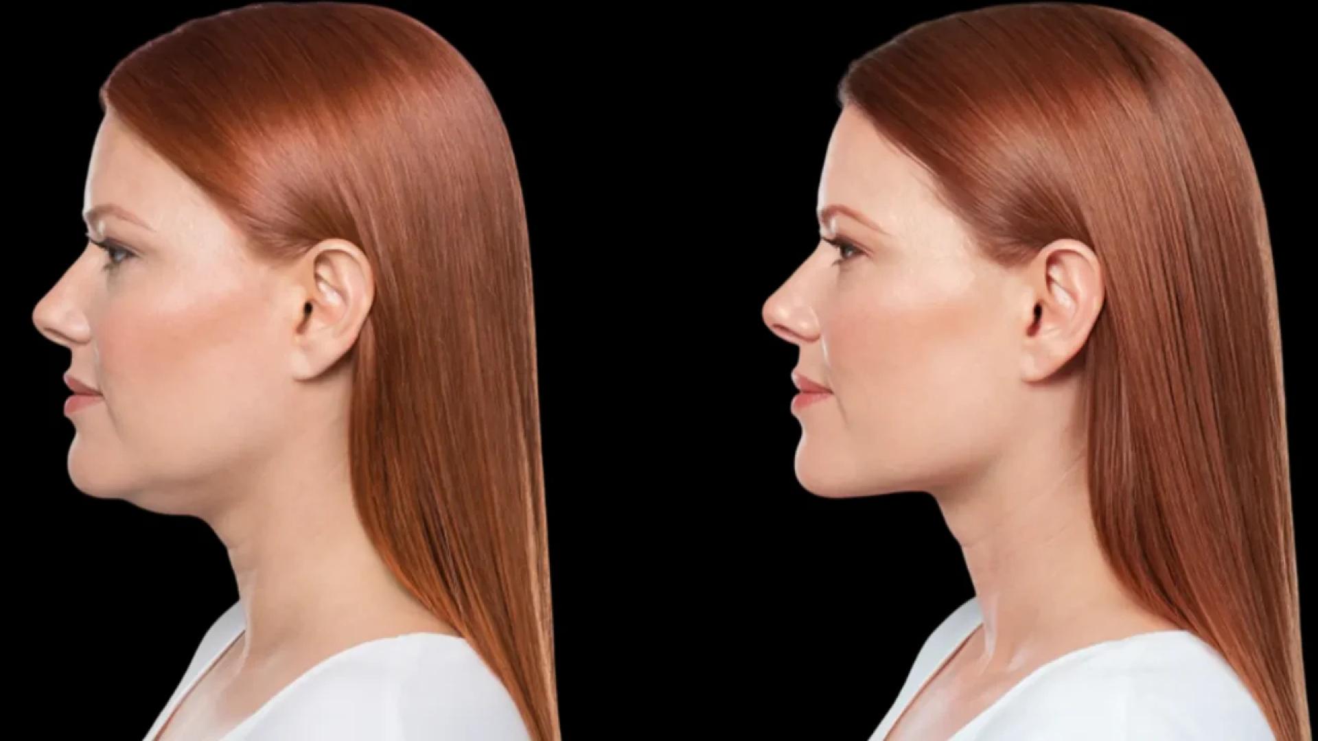 Best Doctors in Dubai for Botox: Personalized Consultations for Lasting Results