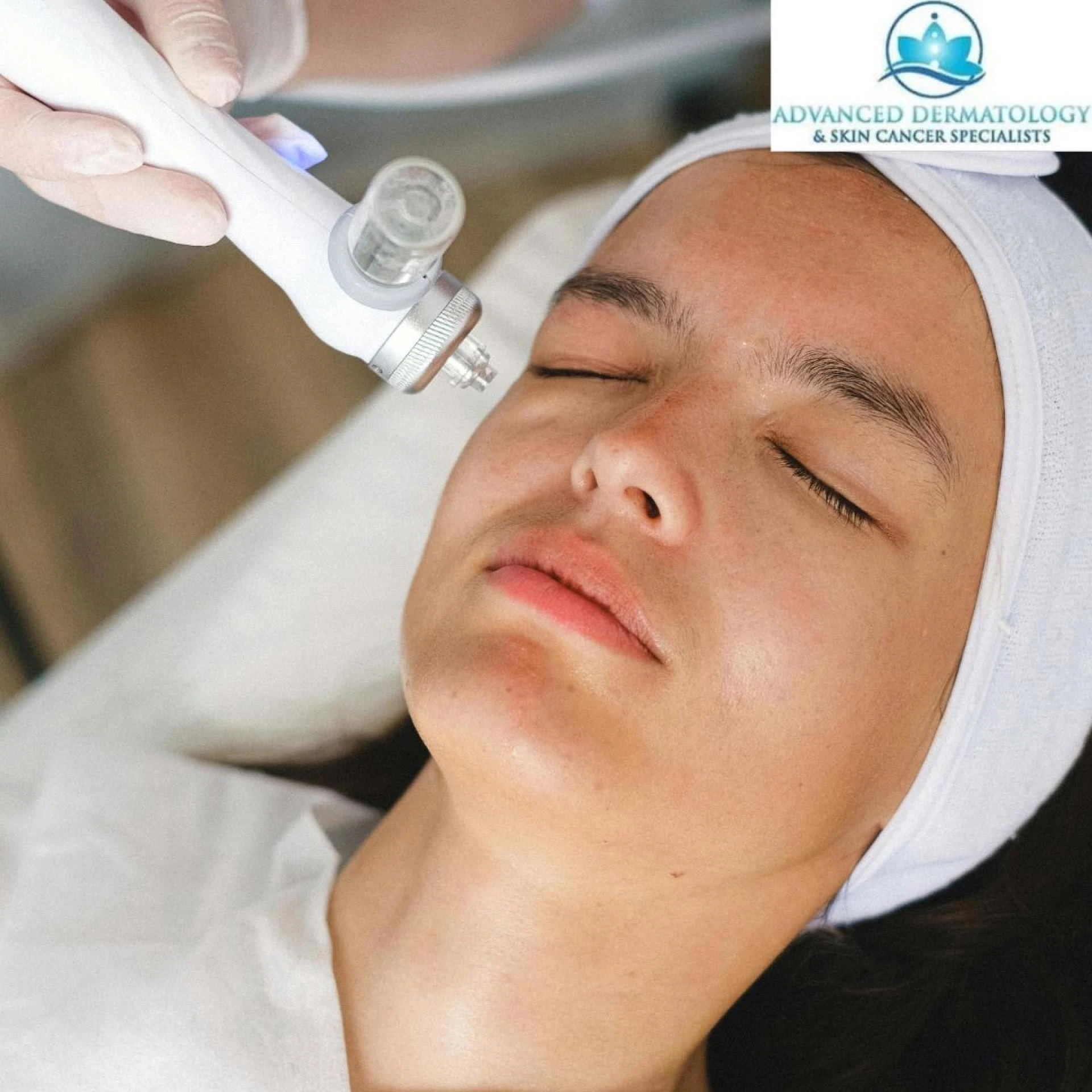 Facing Skin Cancer? Learn Why SRT is a Gentle Yet Powerful Choice