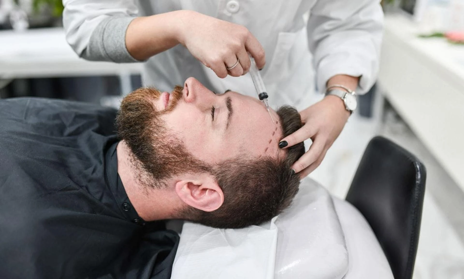 Hair Transplant Turkey: Everything You Need to Know Before Traveling