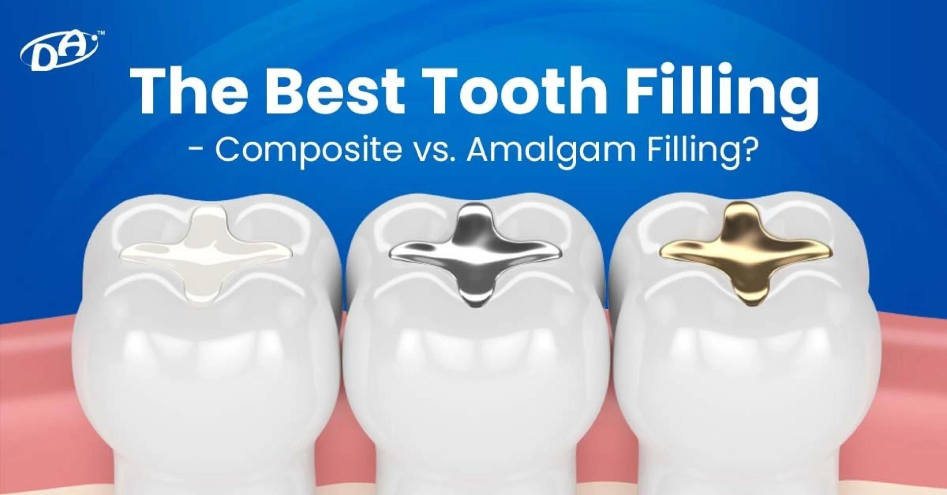 Composite vs. Amalgam Fillings: Which Is Better for Patients