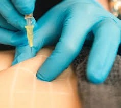 Fat-dissolving injections in Riyadh: Tips for success and achieving the best results