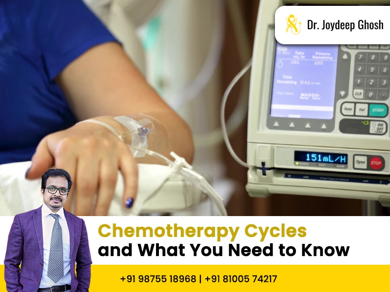 The Role of Chemotherapy Cycles in Cancer Treatment