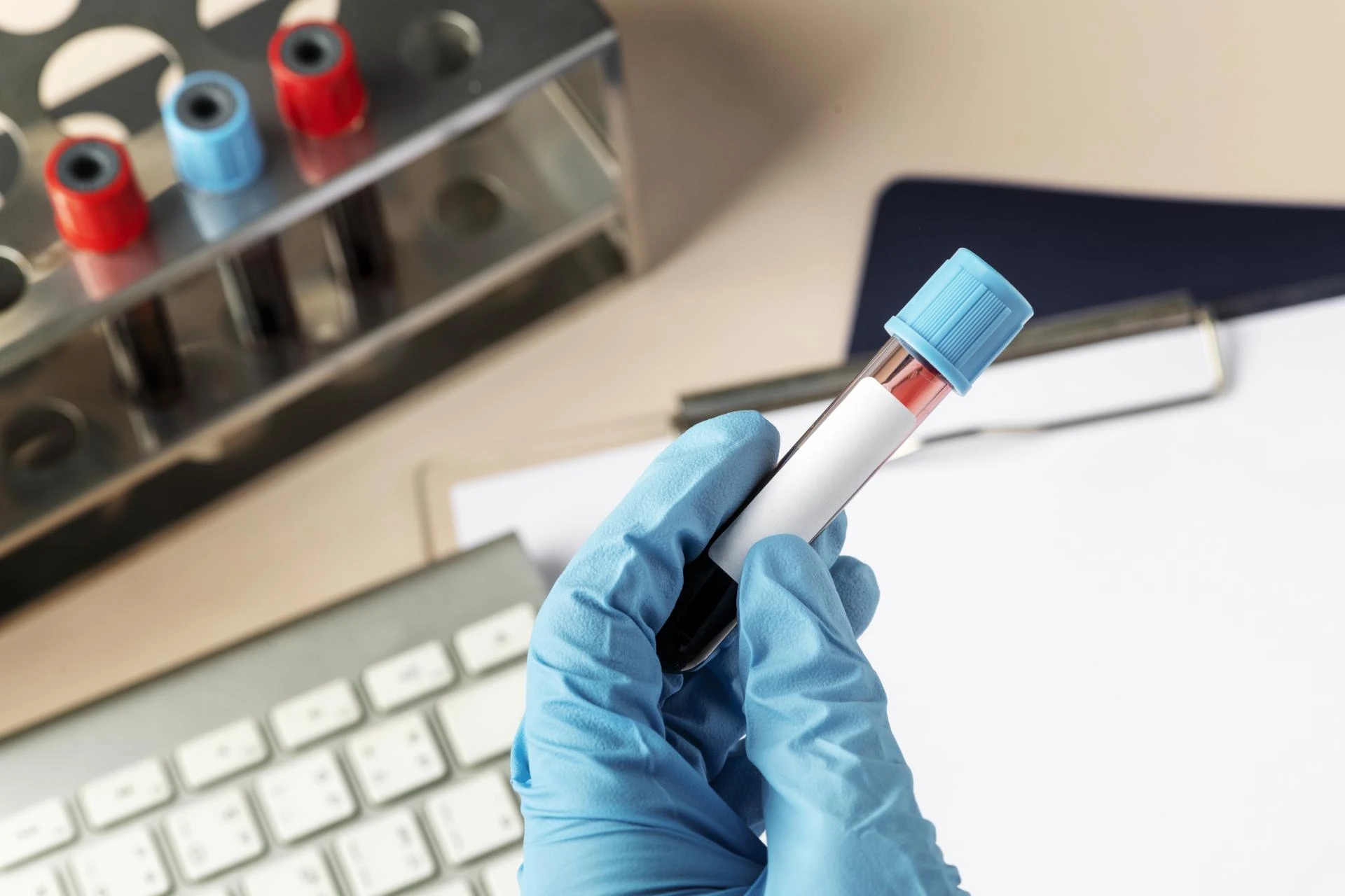Complete Guide to CBC Blood Test: Procedure, Interpretation, and Next Steps