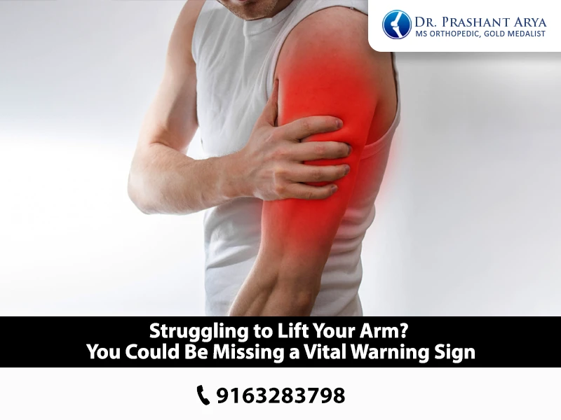 Shoulder Pain While Lifting Your Arm? It Might Be More Serious Than You Think