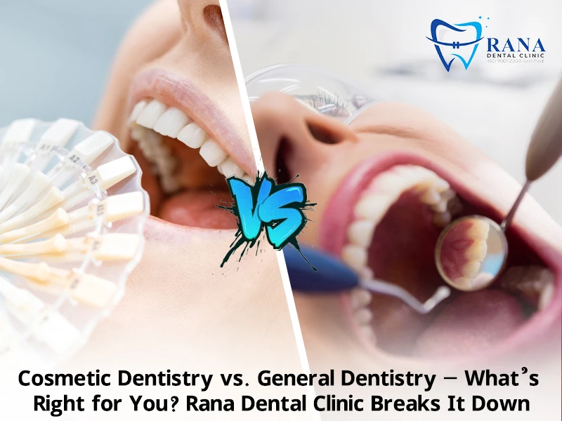 Cosmetic Dentistry vs. General Dentistry – Which One Is Right for You?