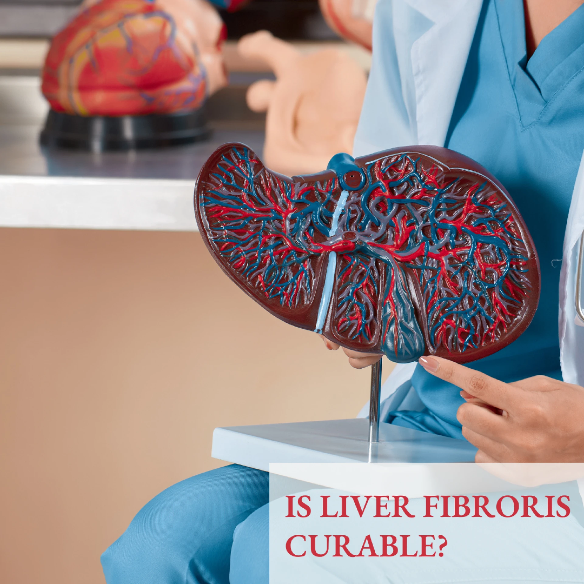 Is liver fibroris Curable? Liver fibrosis specialist in Gurgaon