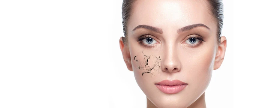 Daily Skincare Routine for Dry Skin in Islamabad’s Weather