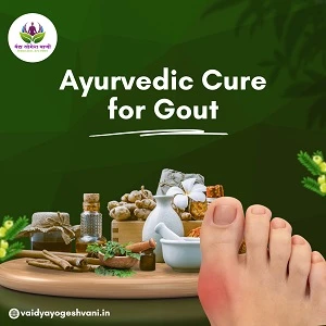 What Are the Benefits of Choosing Ayurveda for Gout Relief