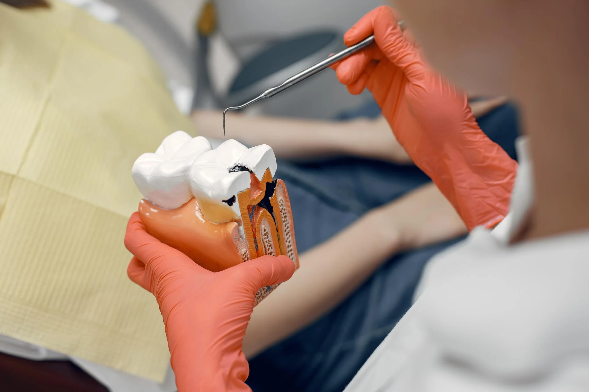 Is a Dental Crown Better Than a Filling for Tooth Damage?