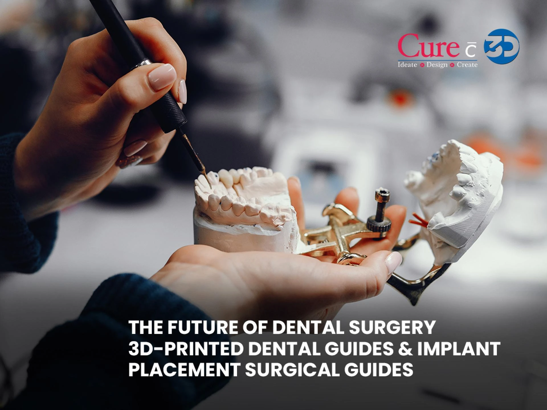 The Future of Dental Surgery: 3D-Printed Dental Guides & Implant Placement Surgical Guides