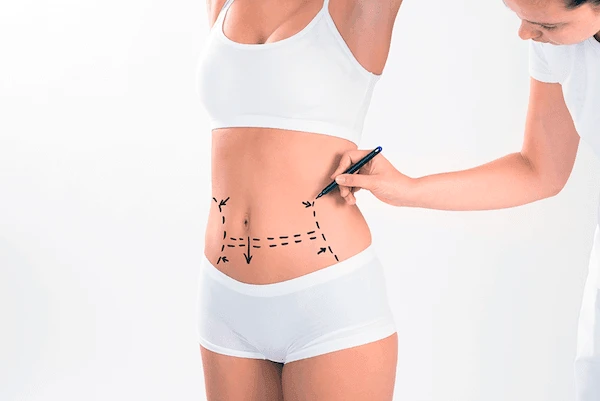 7 Best Solutions for Liposuction Lumpy and Bumpy Results