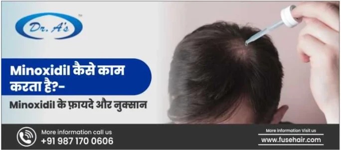 Minoxidil Ke Fayade | Hair Transplant Cost in Delhi