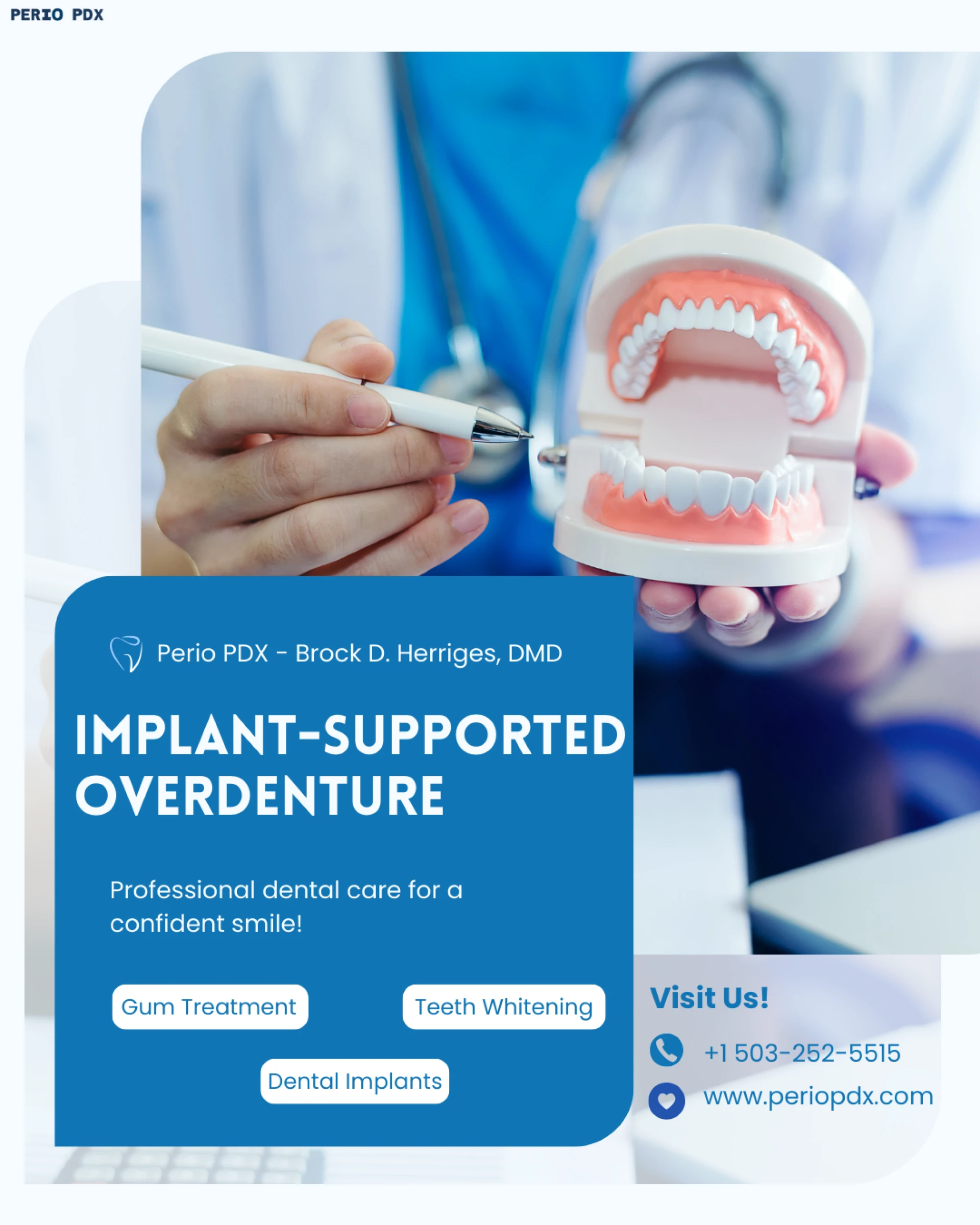 How Implant-Supported Overdenture Performs ?