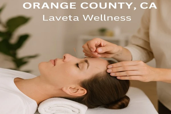 Acupuncture in Orange County, CA: Healing Naturally Through Ancient Wisdom