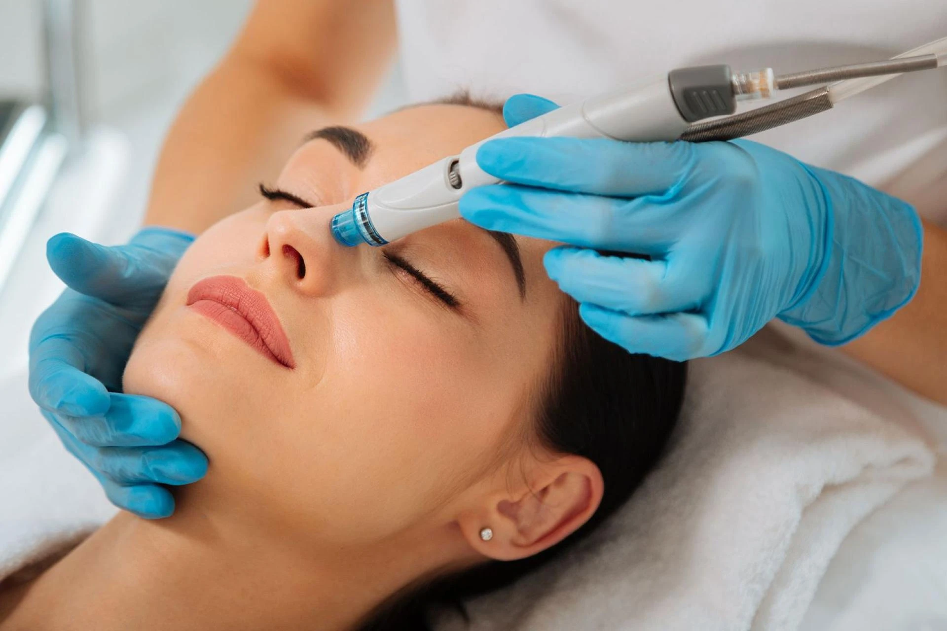 HydraFacial for Hyperpigmentation: Clearer Skin in Islamabad